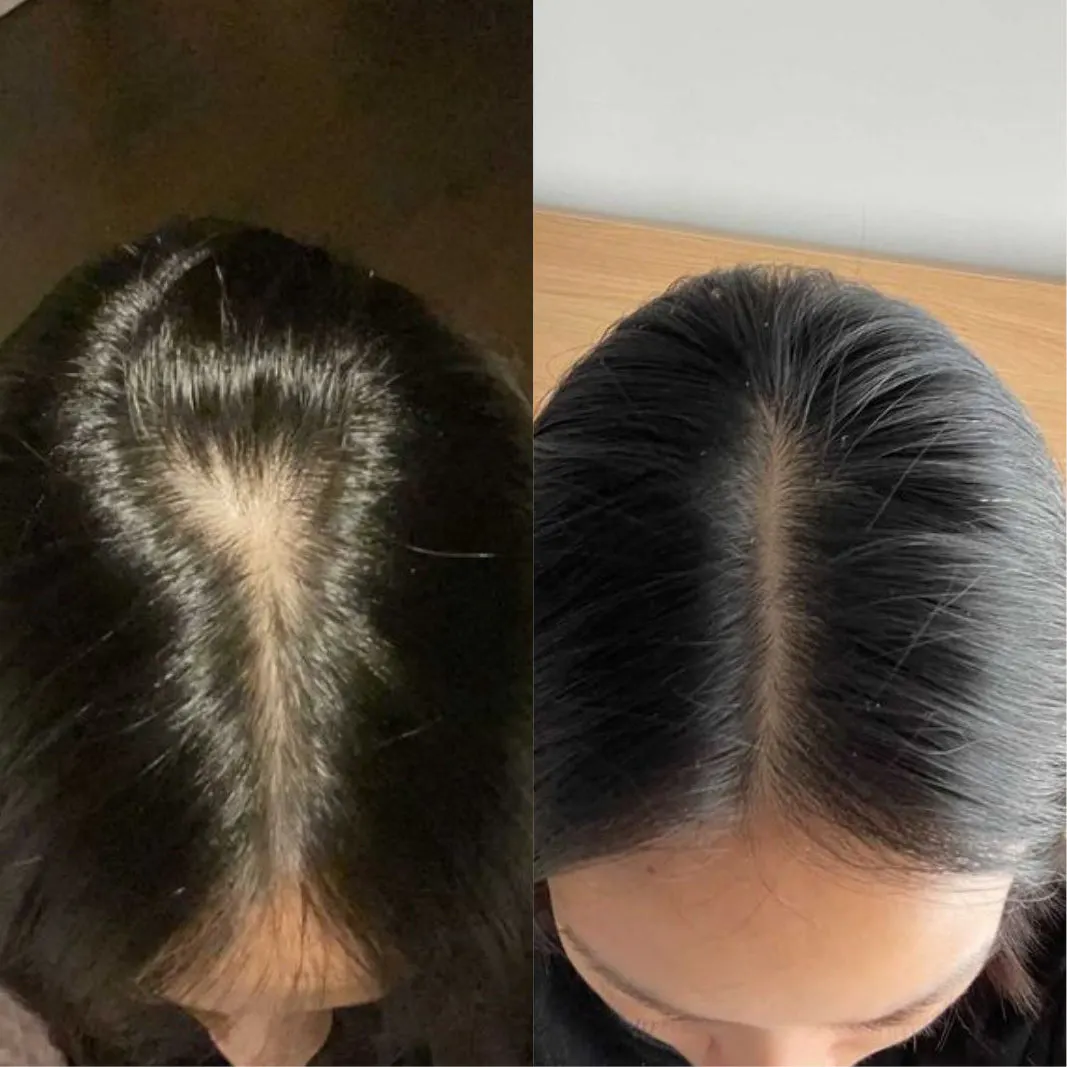 Aéde Power Activist Hair Growth Supplement 180 Tablets - 3 Month Supply, view 4