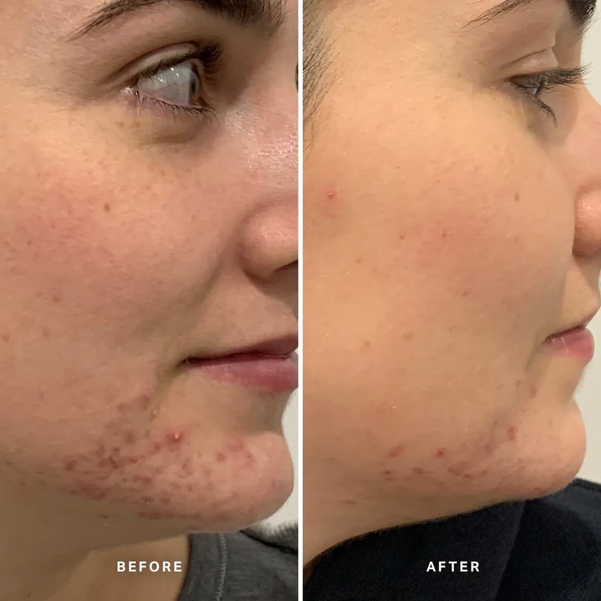 Alpha-H Clear Skin Tonic 30ml, view 3