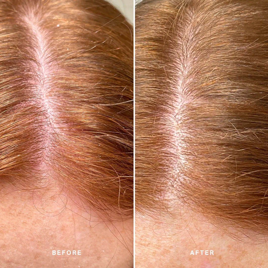 Alpha-H Healthy Exfoliating Scalp Treatment 100ml, view 4