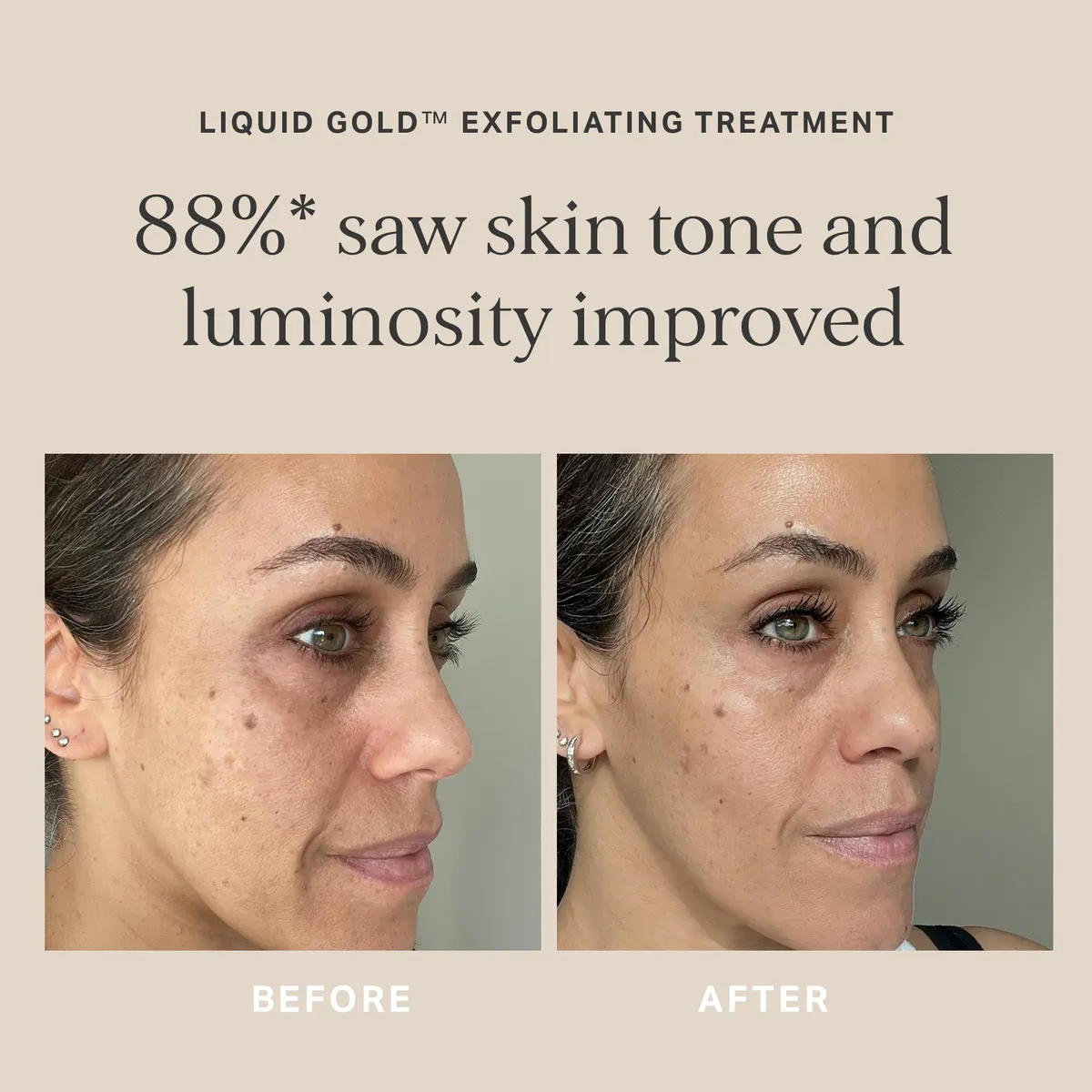 Alpha-H Liquid Gold Exfoliating Treatment with 5% Glycolic Acid 100ml, view 4