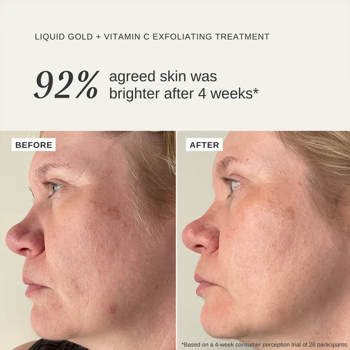 Alpha-H Liquid Gold Exfoliating Treatment with Vitamin C 100ml, view 3