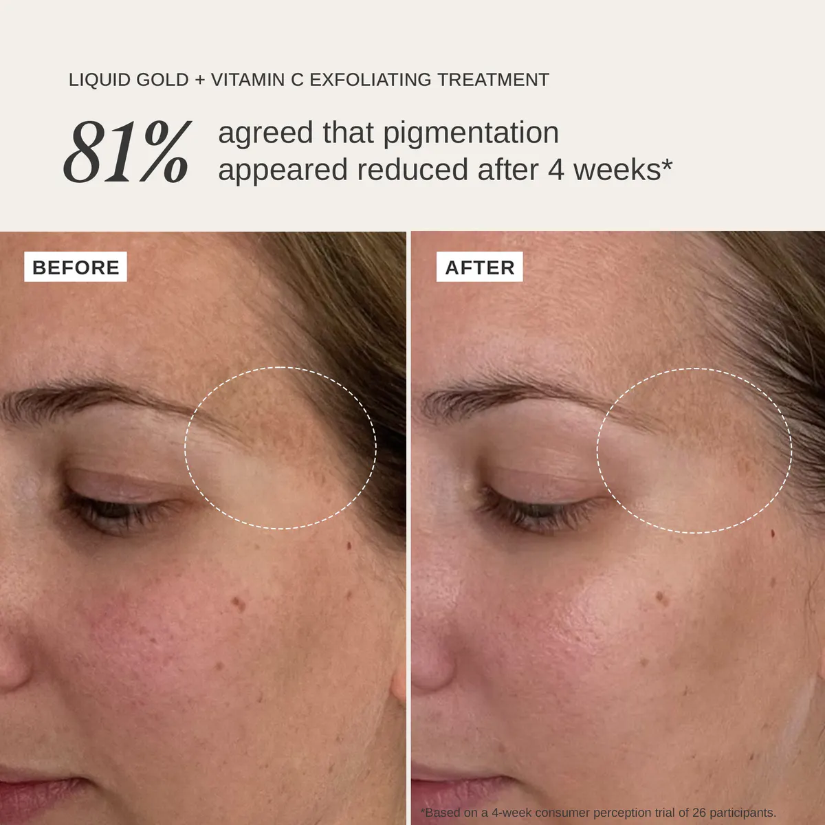Alpha-H Liquid Gold + Vitamin C Trial Kit (3 x Sachets), view 3