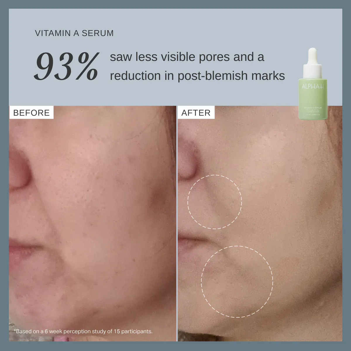 Alpha-H Vitamin A Serum with 0.3% Retinol + 1% Bio-Retinol 25ml, view 2