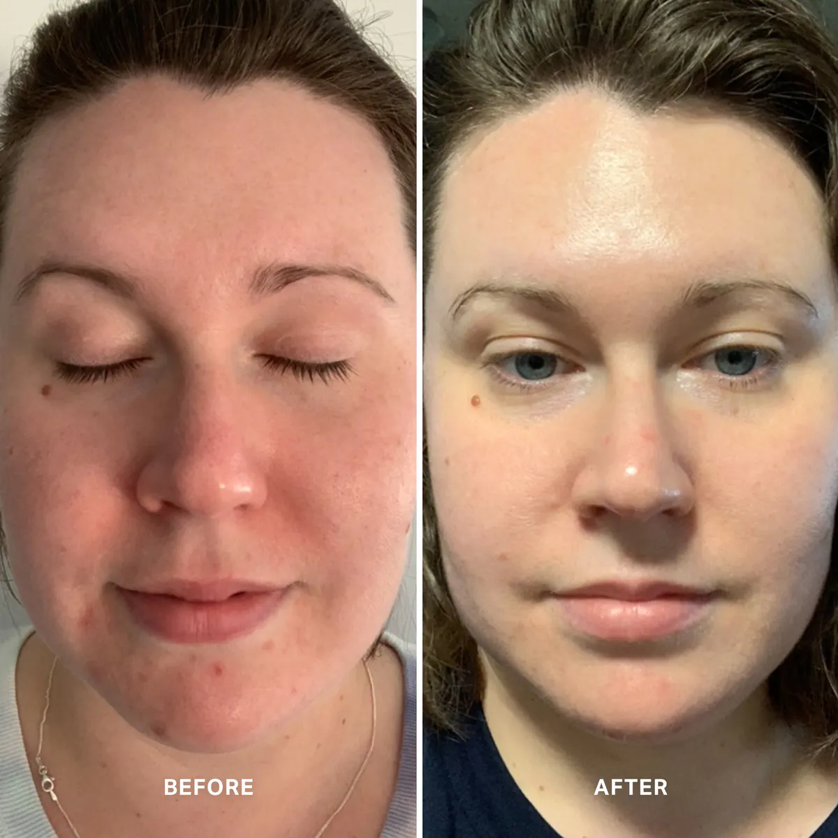 Alpha-H Vitamin A Serum with 0.5% Retinol 10mL, view 4