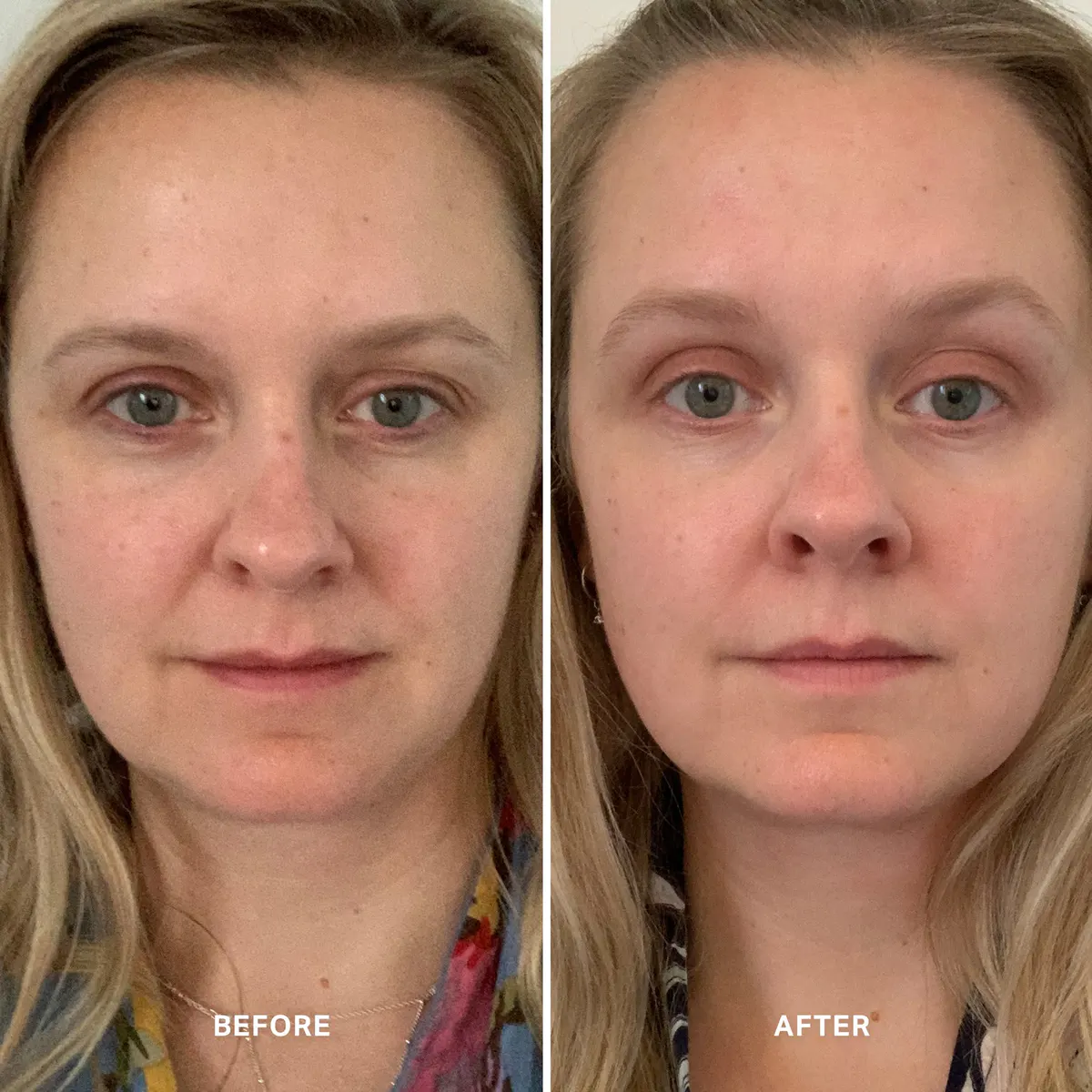Alpha-H Vitamin A with 0.5% Retinol 25ml, view 4