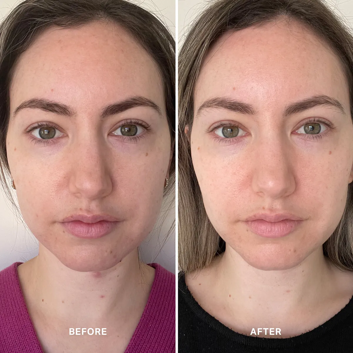 Alpha-H Vitamin B with 0.5% Niacinamide 25ml, view 2