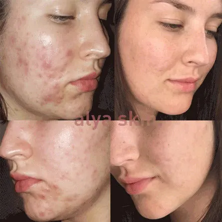 Alya Skin Ultimate Skincare Bundle, view 2