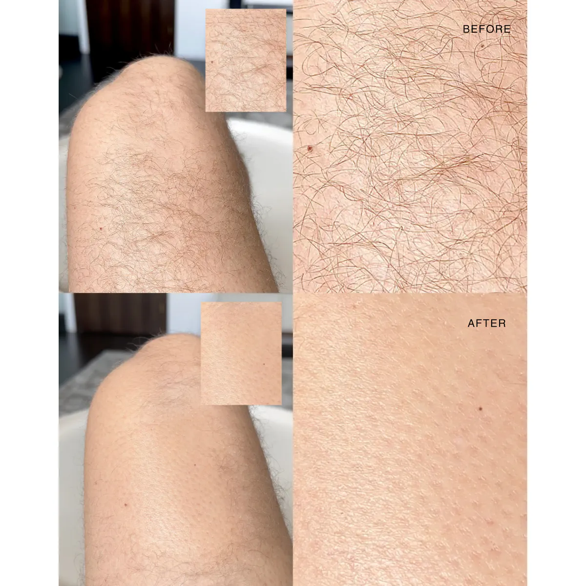 ANSWR Exfoliating Hair Removal Drop, view 4