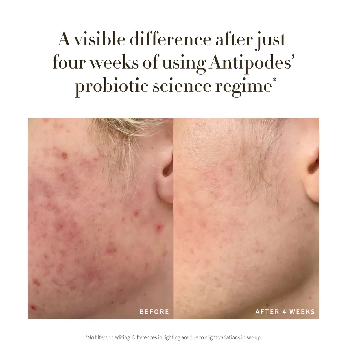 Antipodes Credo Probiotic Anti-Blemish Serum 30ml, view 4