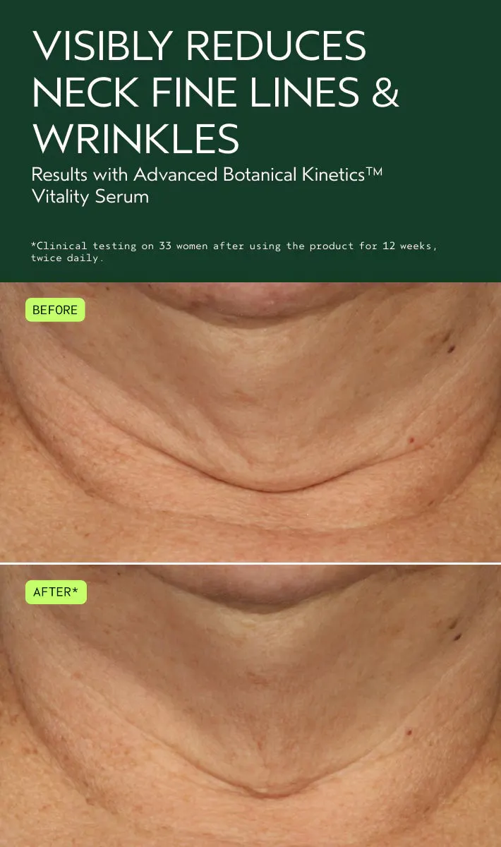 Aveda Advanced Botanical Kinetics™ Vitality Serum 30ml, view 3