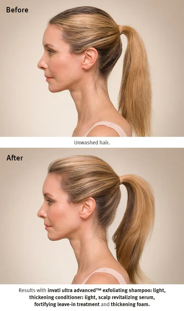 Aveda Invati Ultra Advanced™ Light Quad Bundle, view 3