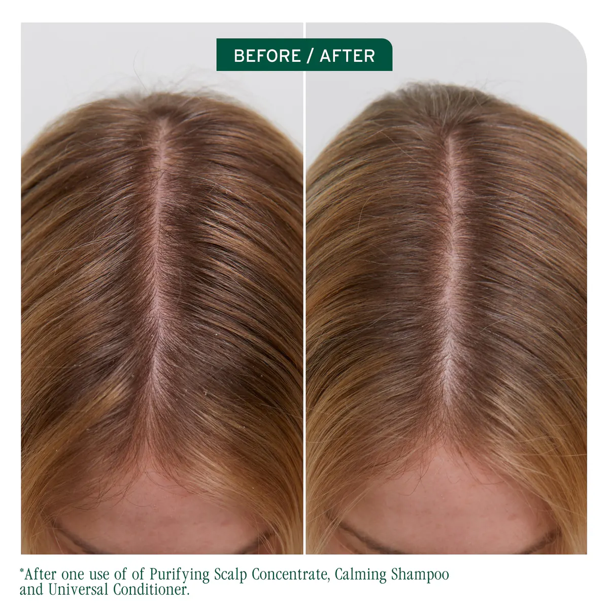 Biolage Scalp Sync Universal Conditioner 236ml, view 2