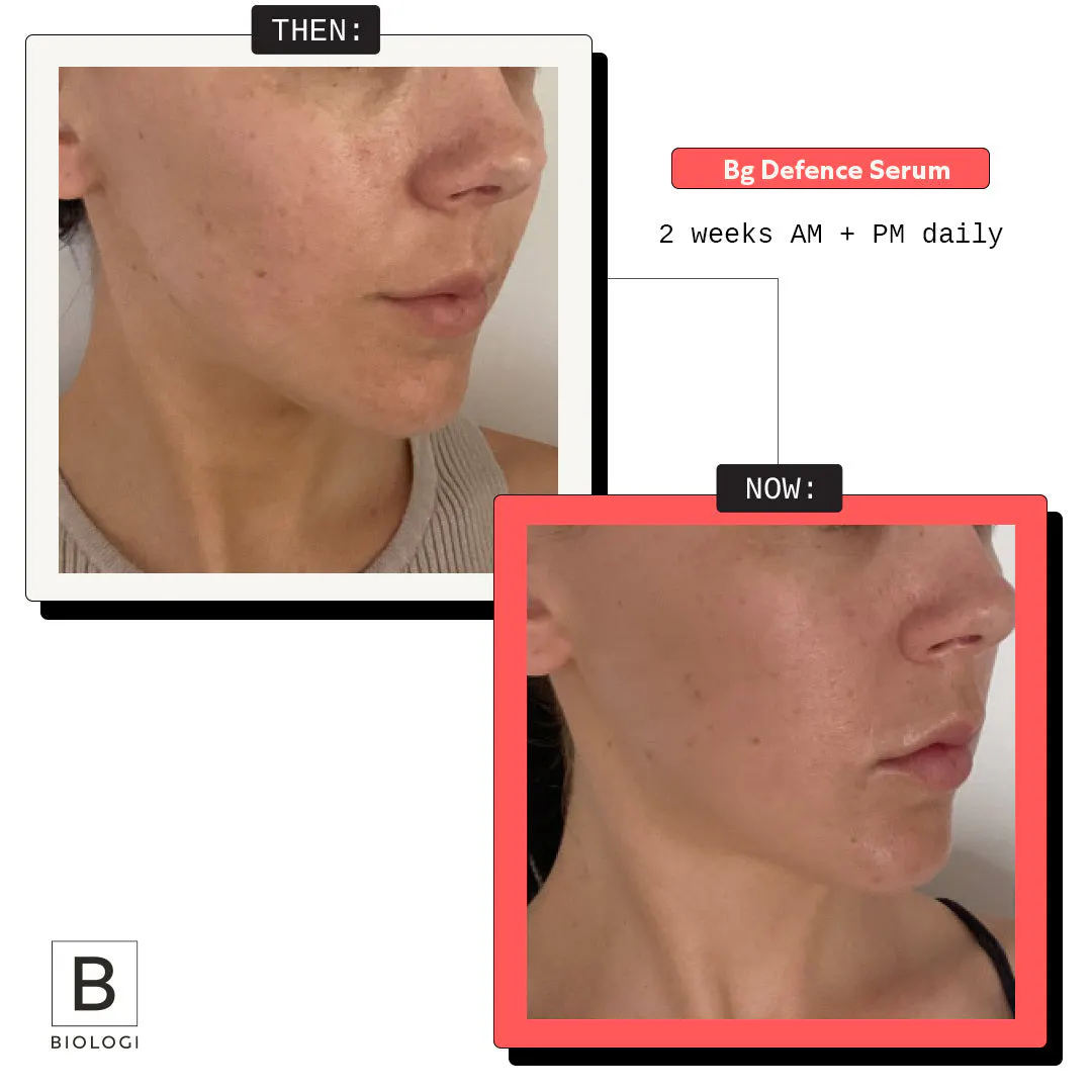 Biologi Bg Defence Anti-Pollution Serum 20ml, view 2