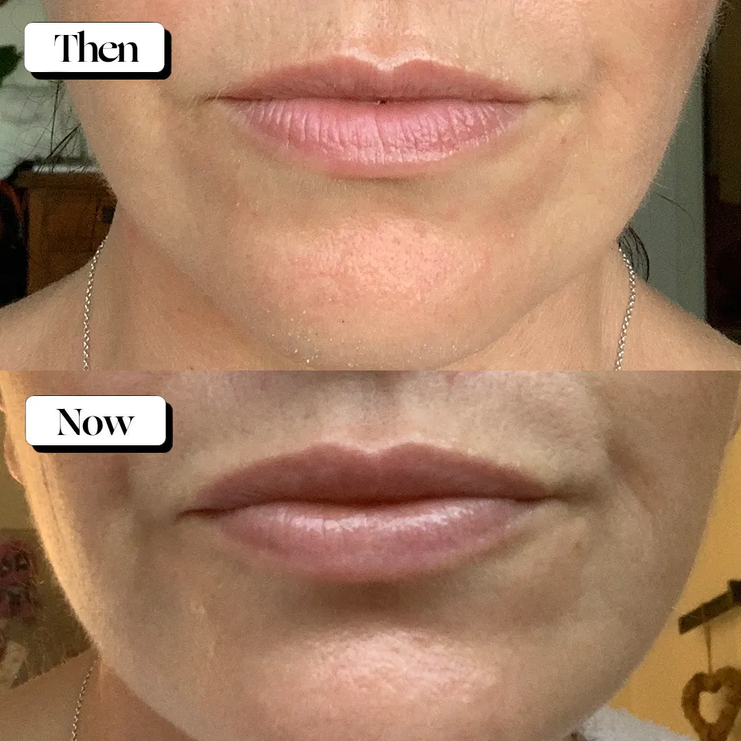 Biologi Bl Nourish Lip Serum 5ml, view 2