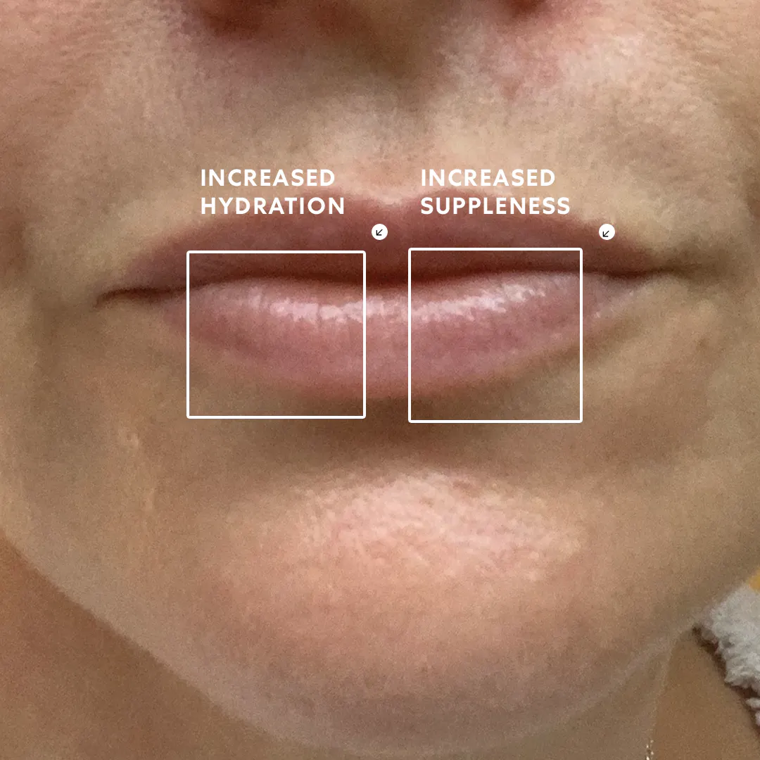 Biologi Bl Nourish Lip Serum 5ml, view 4