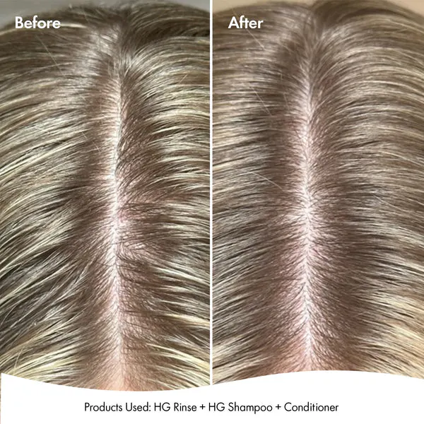 Bondi Boost Hair Growth Clarifying Rinse 250ml, view 6