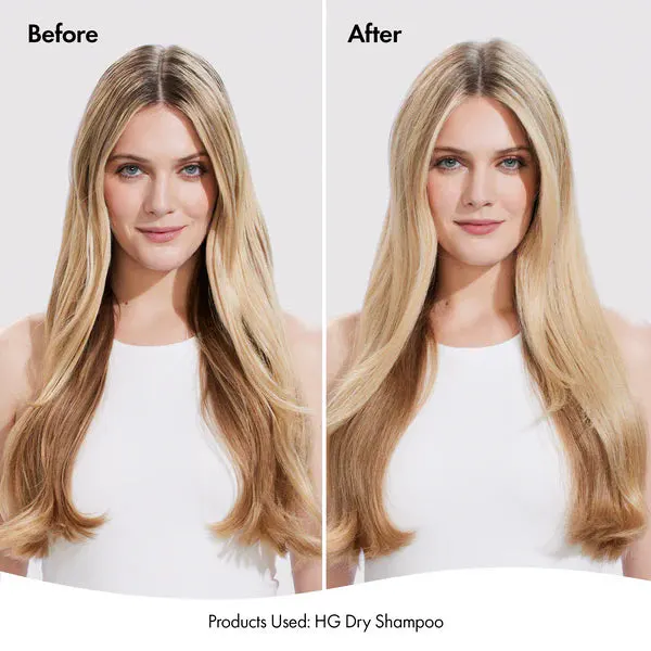 Bondi Boost Hair Growth Dry Shampoo 200ml, view 5