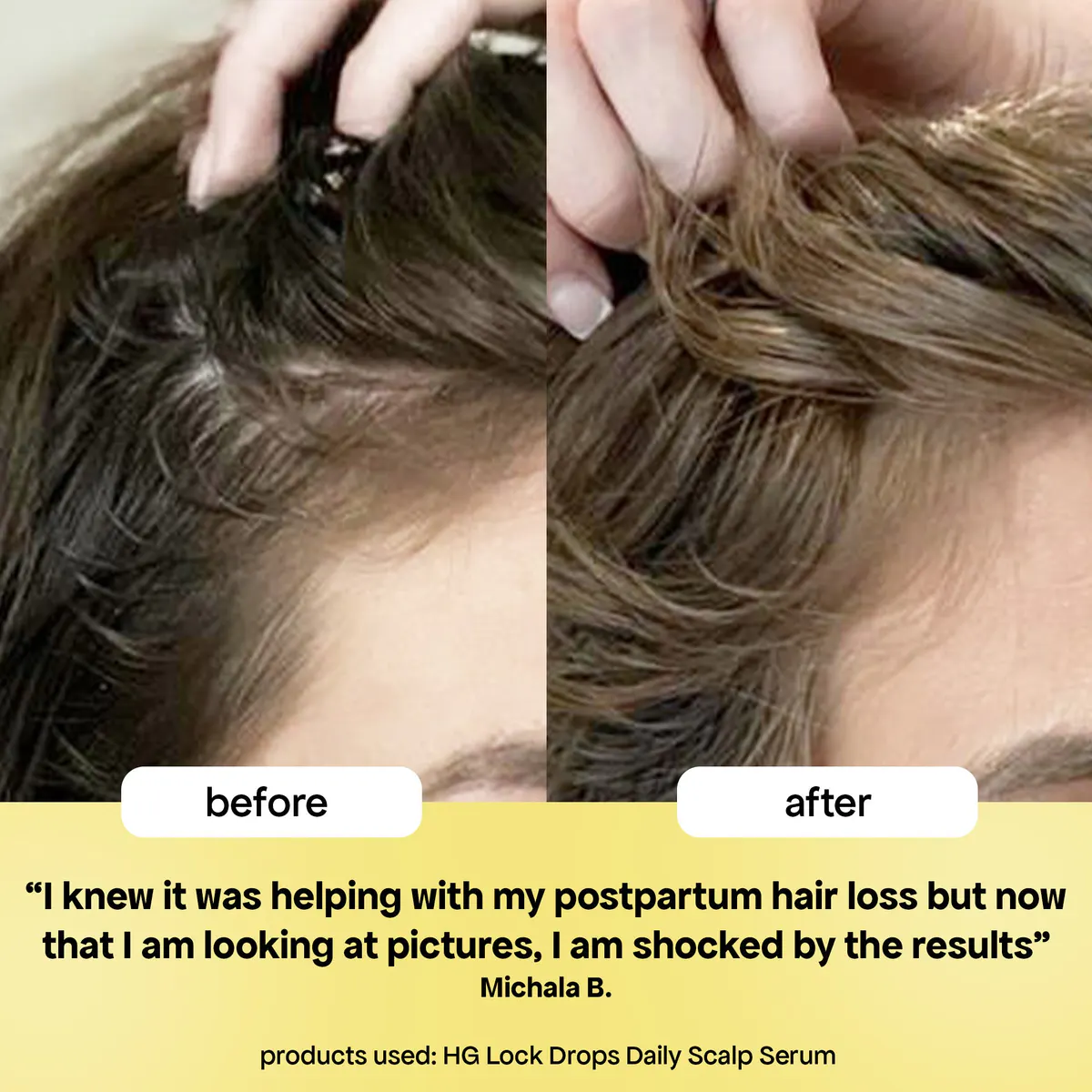 Bondi Boost Lock Drops Anti-Shedding Scalp & Hair Serum 30ml, view 3