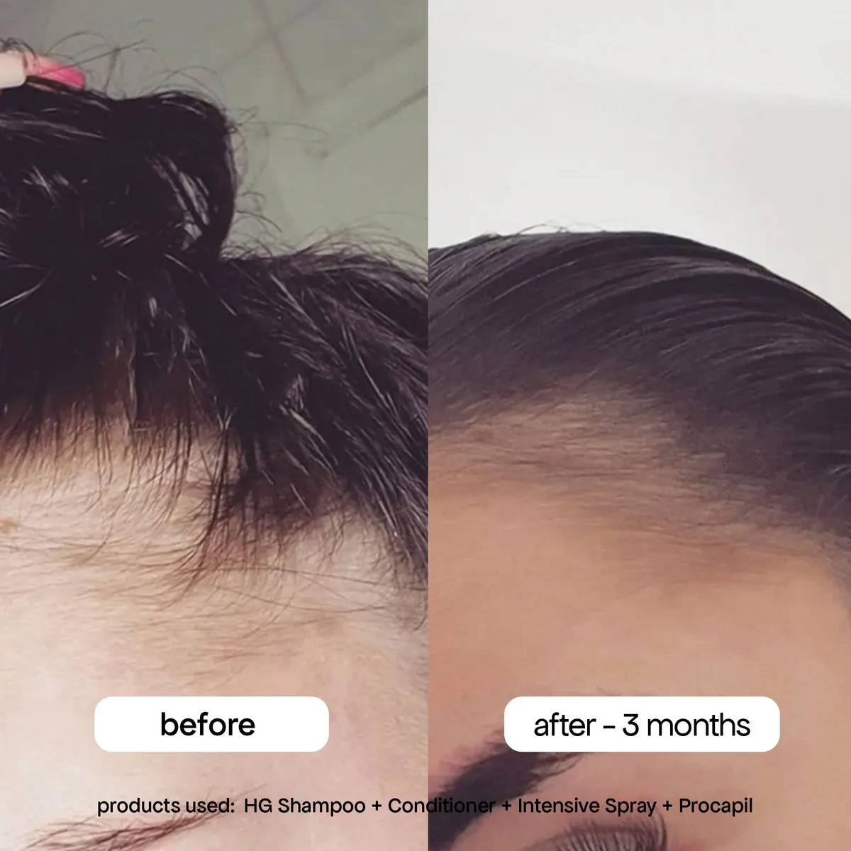 Bondi Boost Procapil Hair Tonic 125ml, view 11