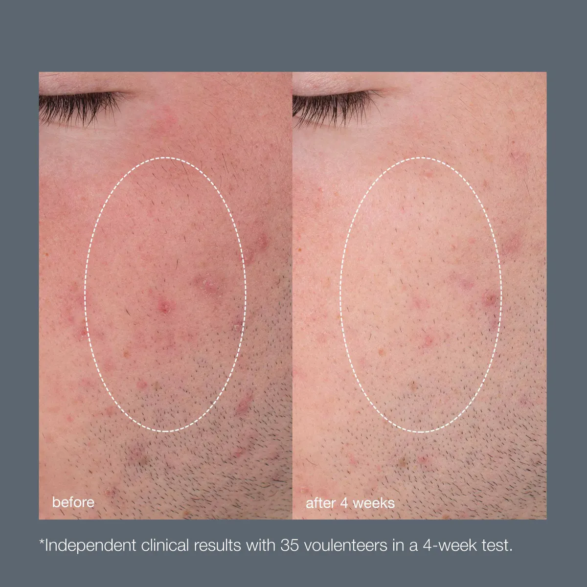 Dermalogica Daily Microfoliant 74g, view 2
