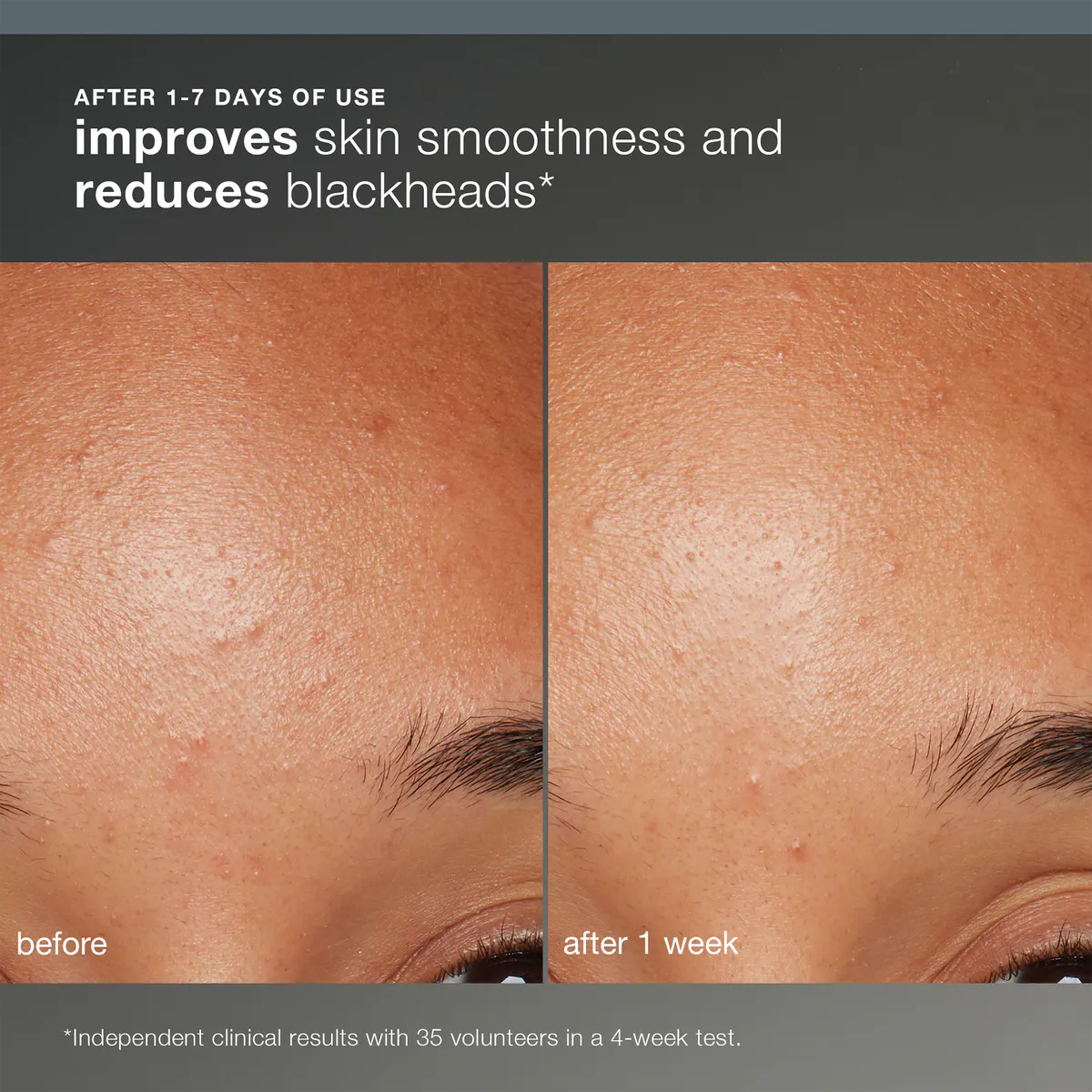 Dermalogica Daily Microfoliant 74g, view 4