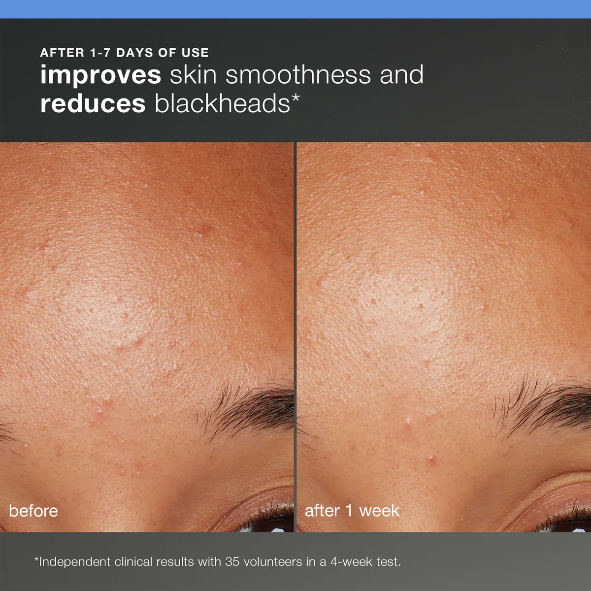 Dermalogica Discover Healthy Skin Kit, view 2