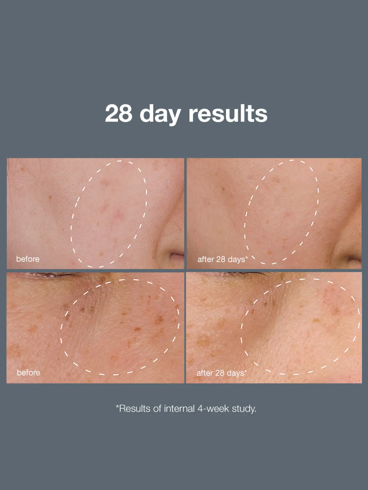 Dermalogica Powerbright Dark Spot System Pack, view 3