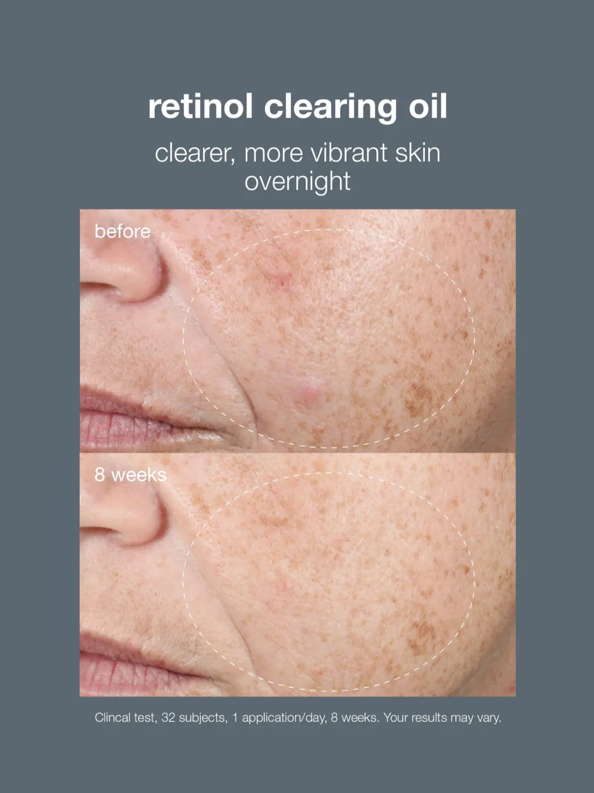 Dermalogica Retinol Clearing Oil 30ml, view 3