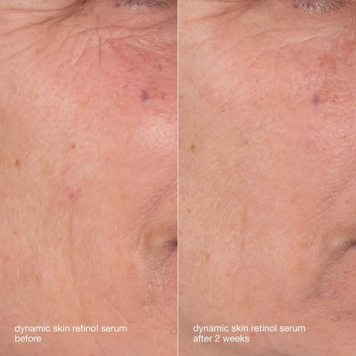 Dermalogica Skin Aging Solutions Kit, view 4