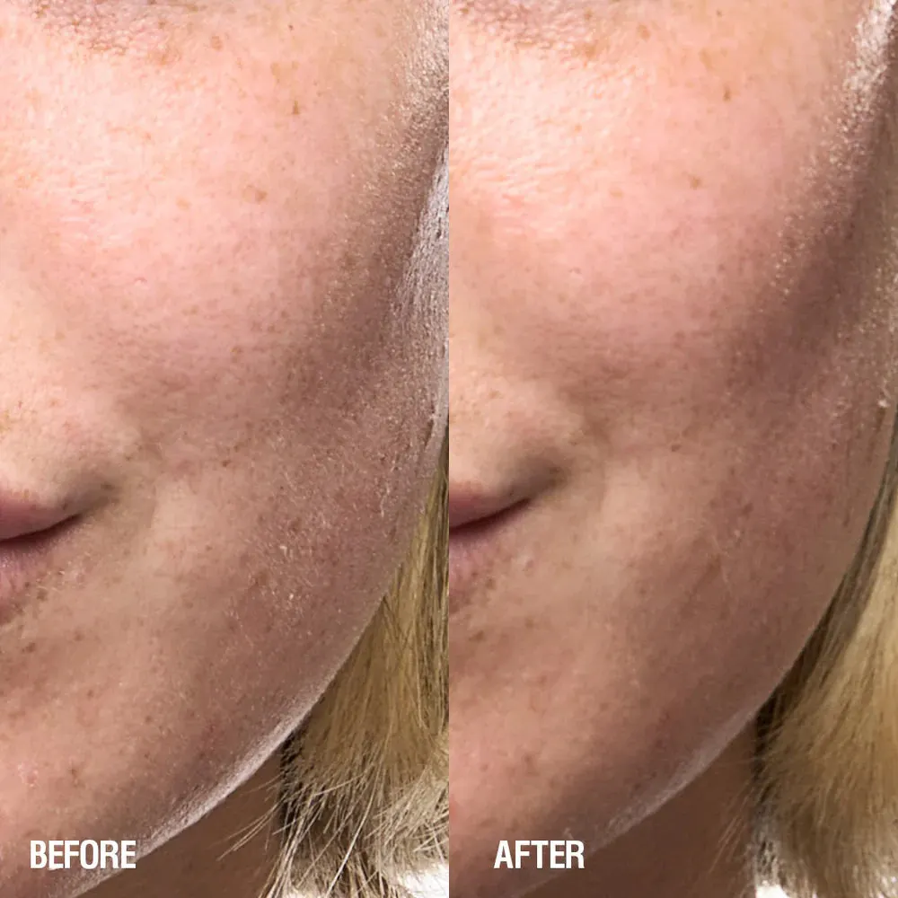 Grown Alchemist Skin Renewal Serum 25ml, view 3