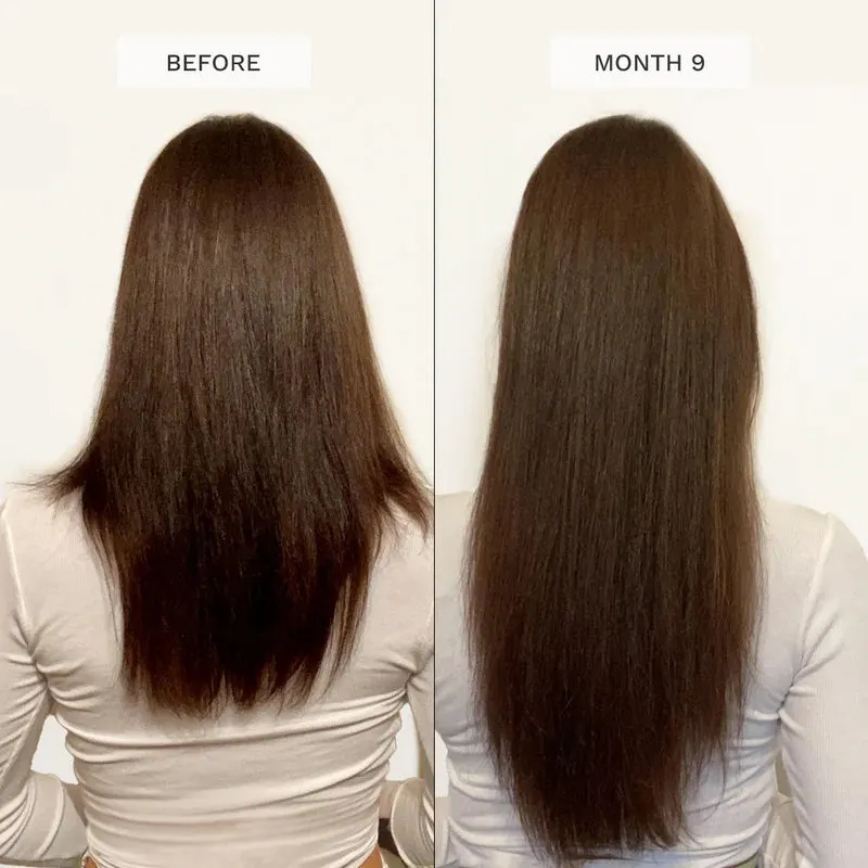 Hairburst Shampoo & Conditioner Duo Pack, view 3