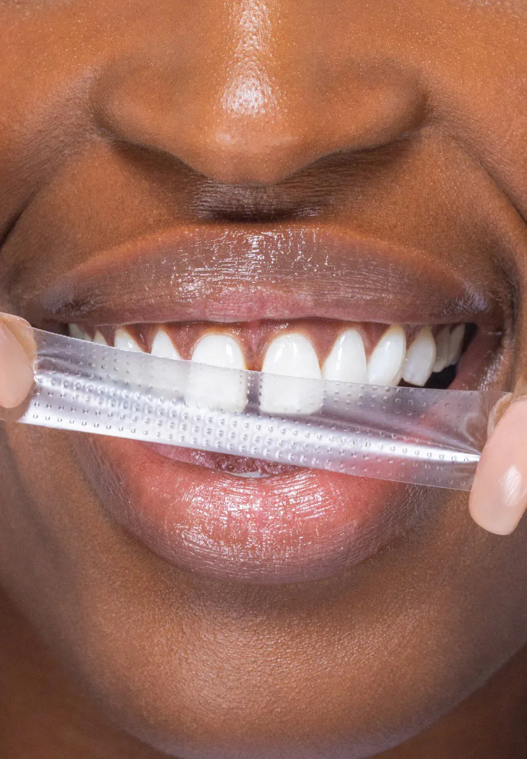 hismile Ultimate Whitening Bundle, view 5