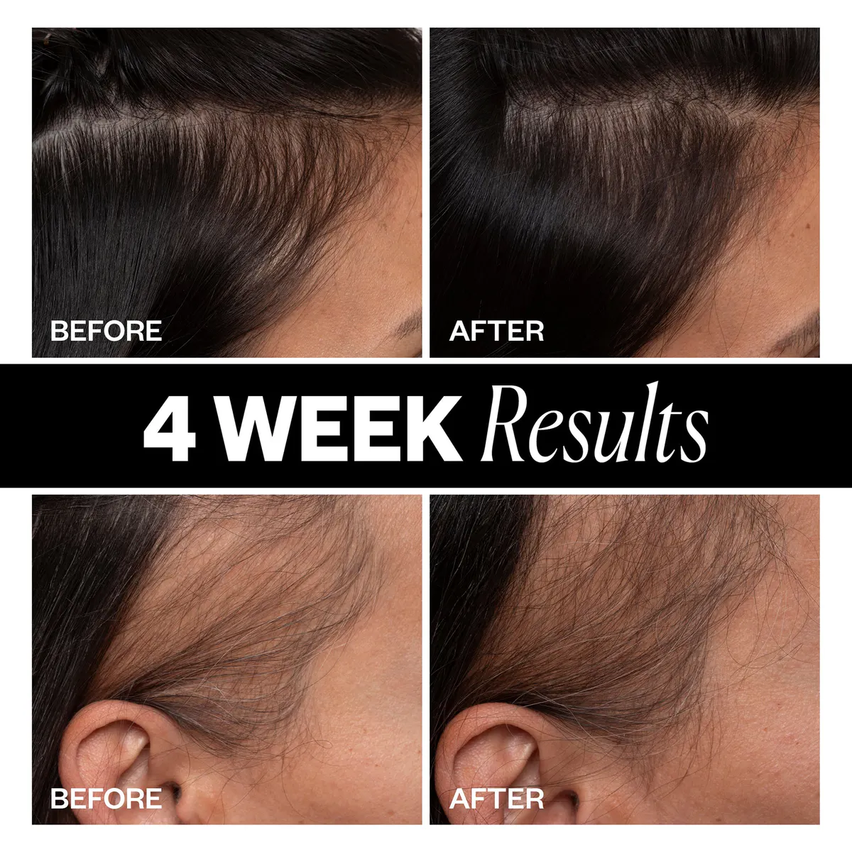 IGK SPONSORED Hair Density Scalp Treatment 63ml, view 3