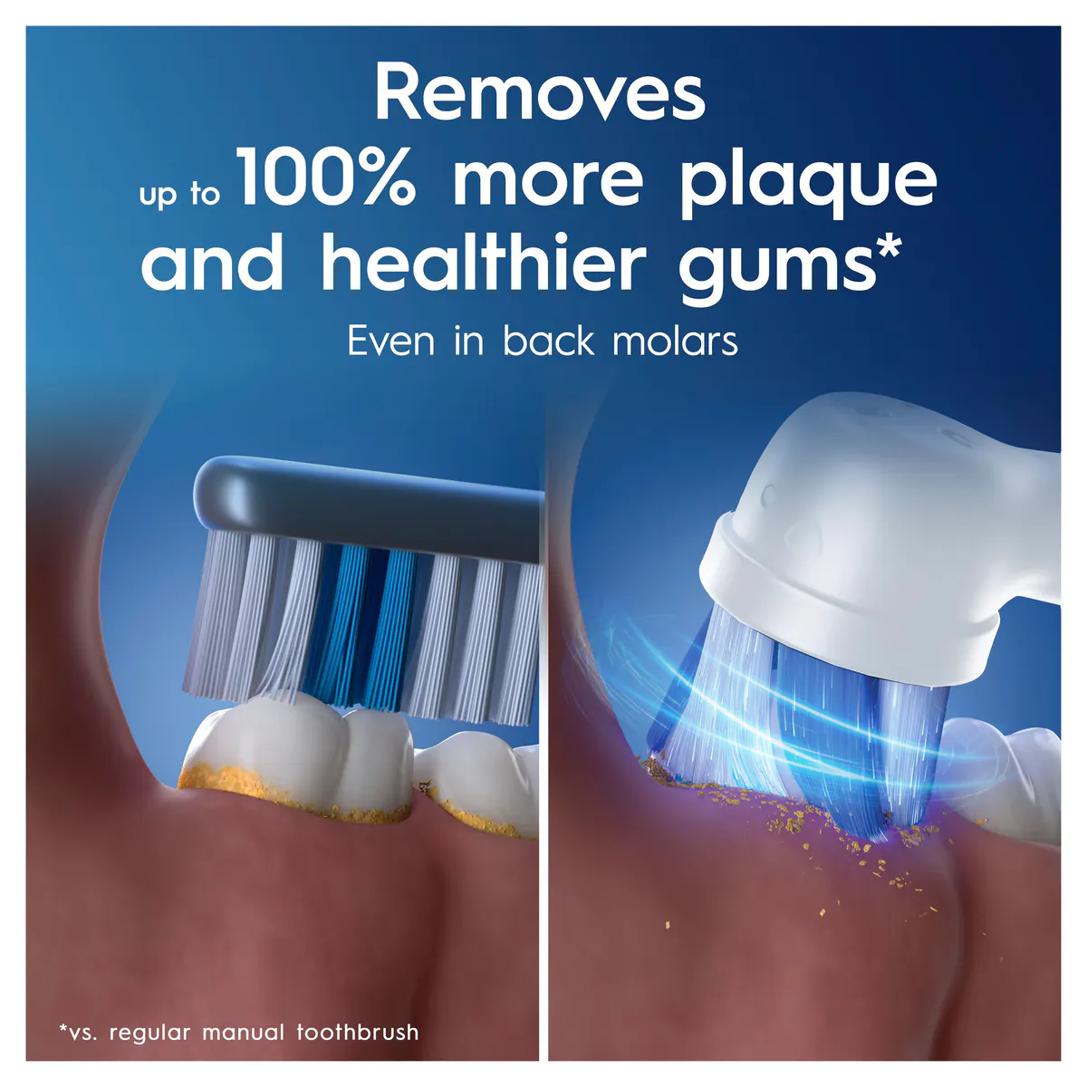Oral-B iO Series 3 Clean & Gum Protect - Ice Blue, view 4
