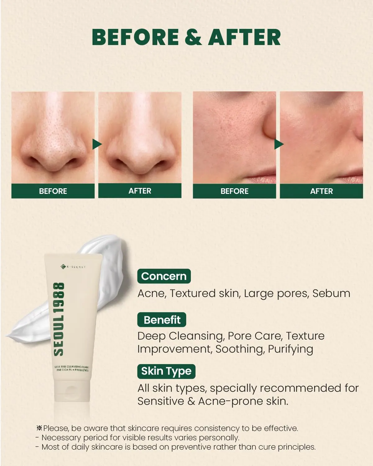 K-SECRET SEOUL 1988 Pine Cica 1% + Probiotics Cleansing Foam 150ml, view 4