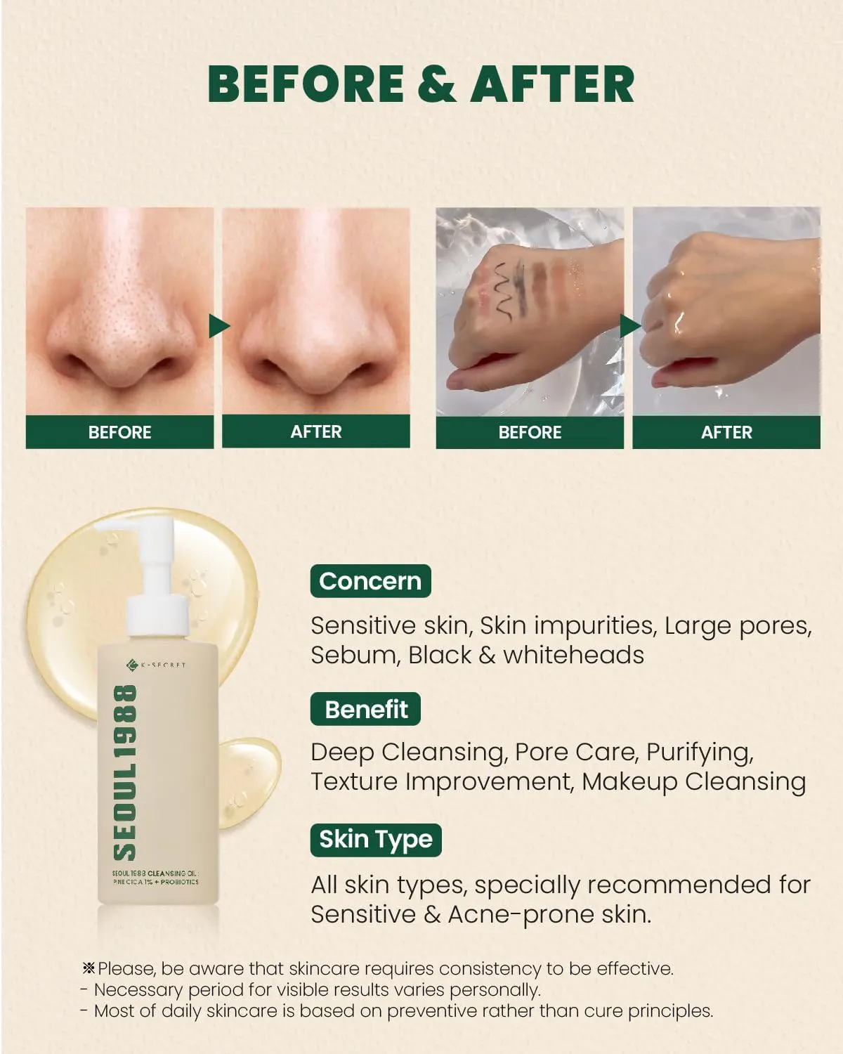 K-SECRET SEOUL 1988 Pine Cica 1% + Probiotics Cleansing Oil 200ml, view 4