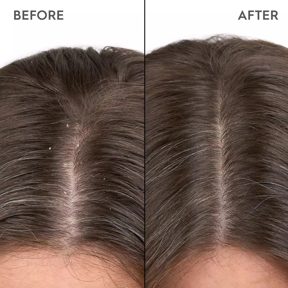 Kerasilk Anti-Dandruff Scalp Serum 100ml, view 2
