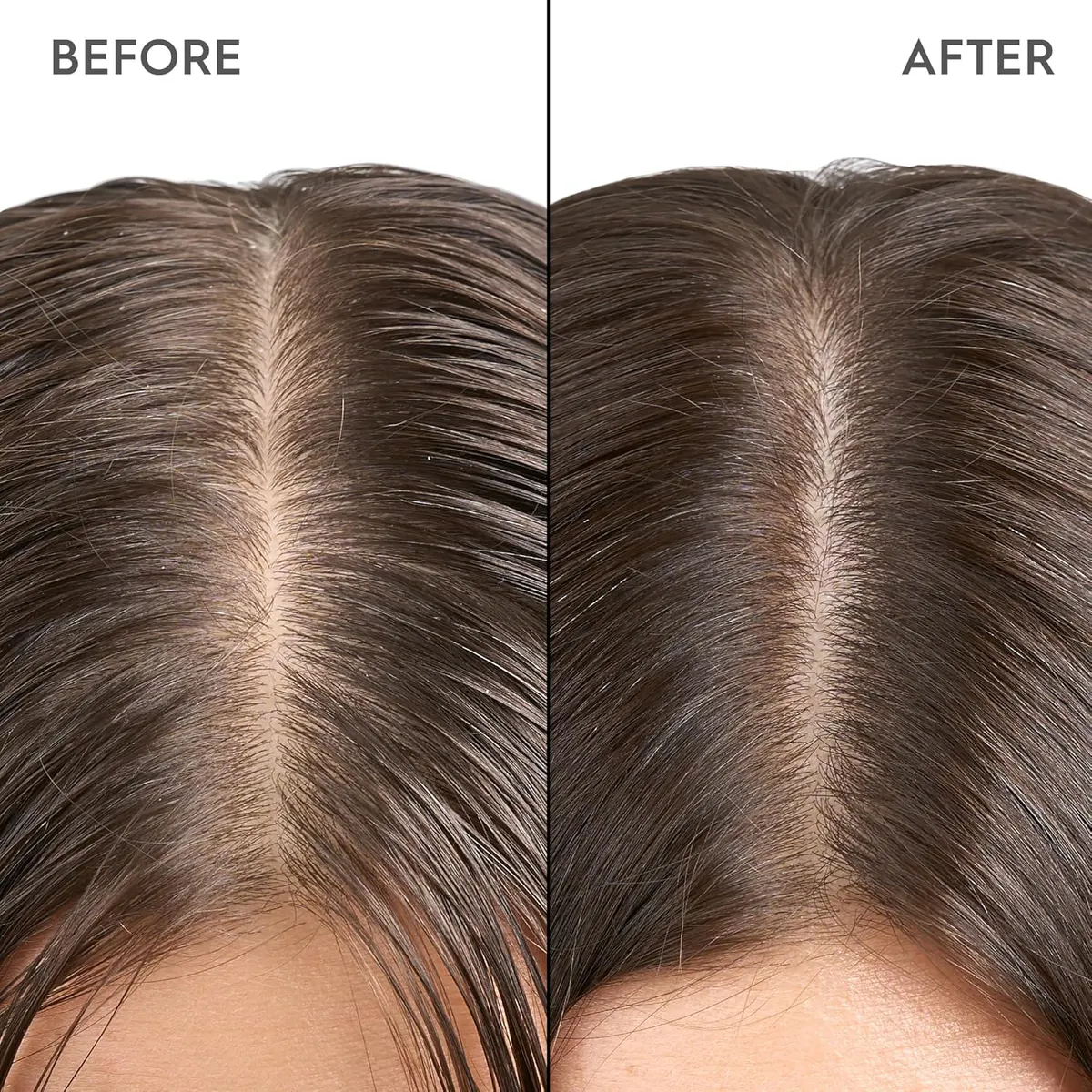 Kerasilk Exfoliating Scalp & Hair Treatment 200ml, view 2