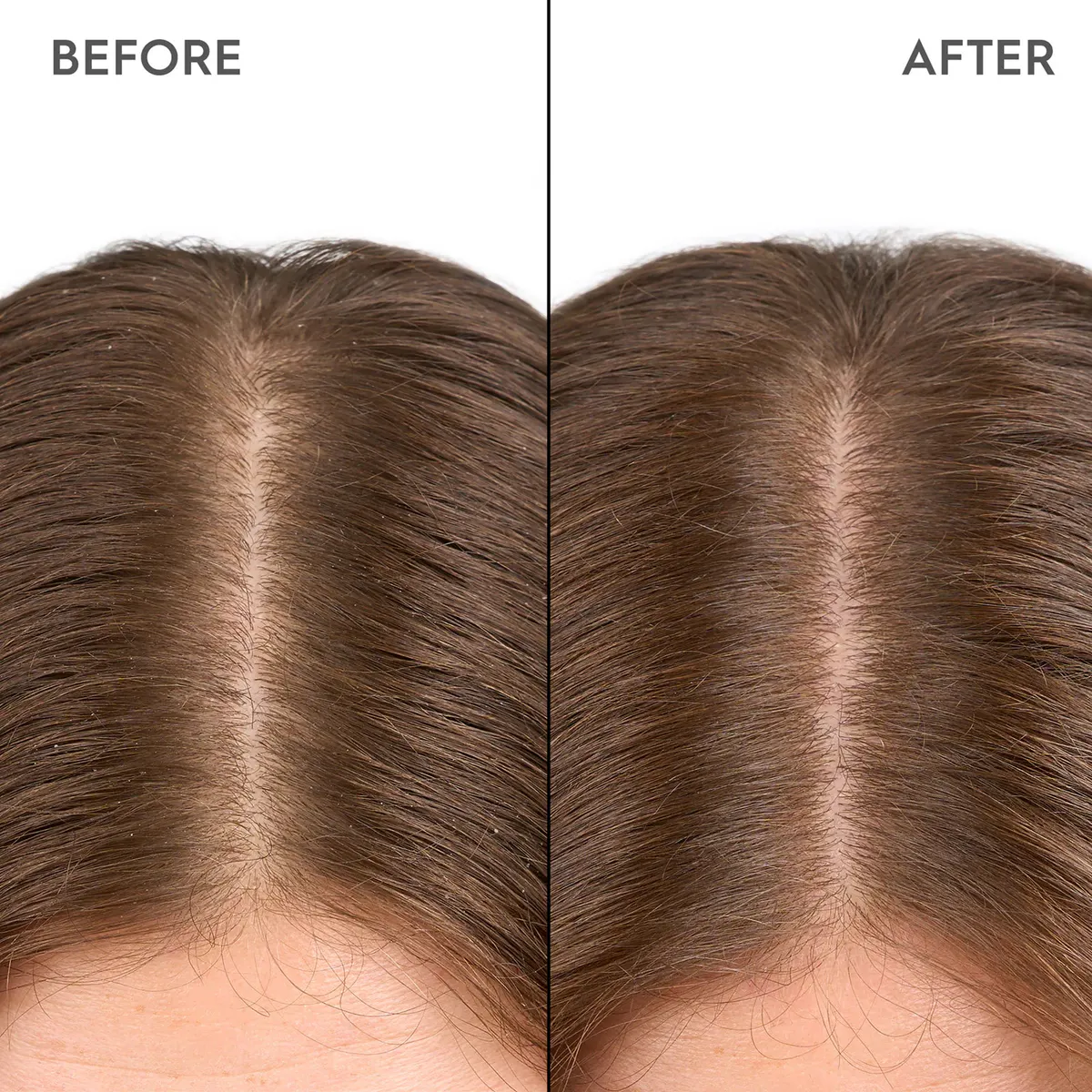 Kerasilk Moisturizing Scalp Drops 100ml, view 2