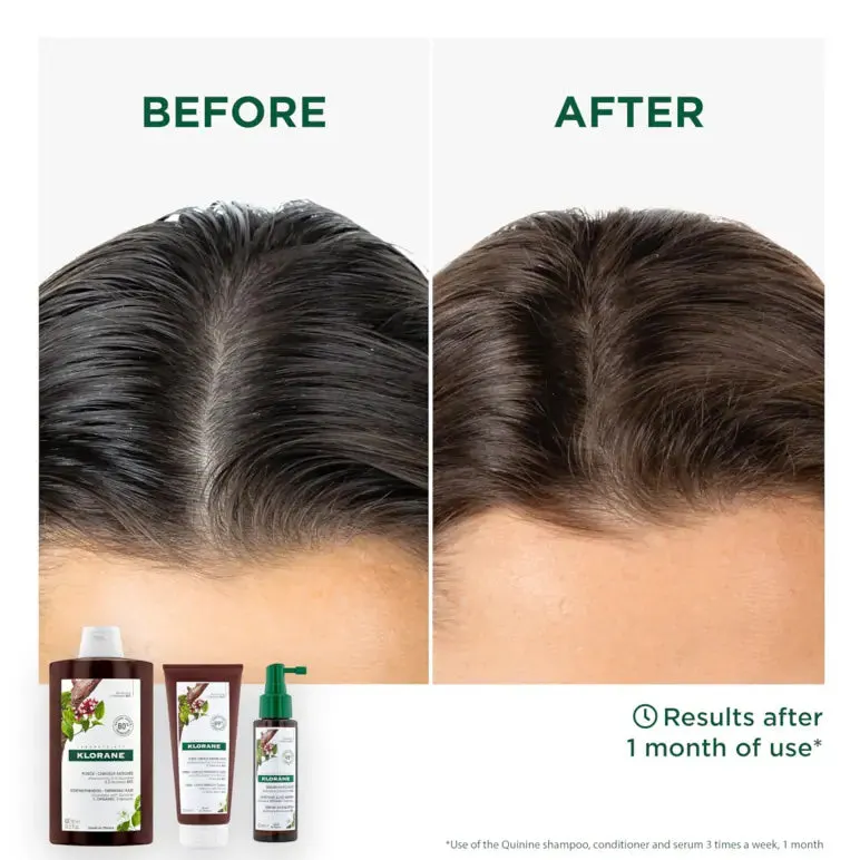 Klorane Conditioner With Quinine & Organic Edelweiss - Thinning Hair 200ml, view 3
