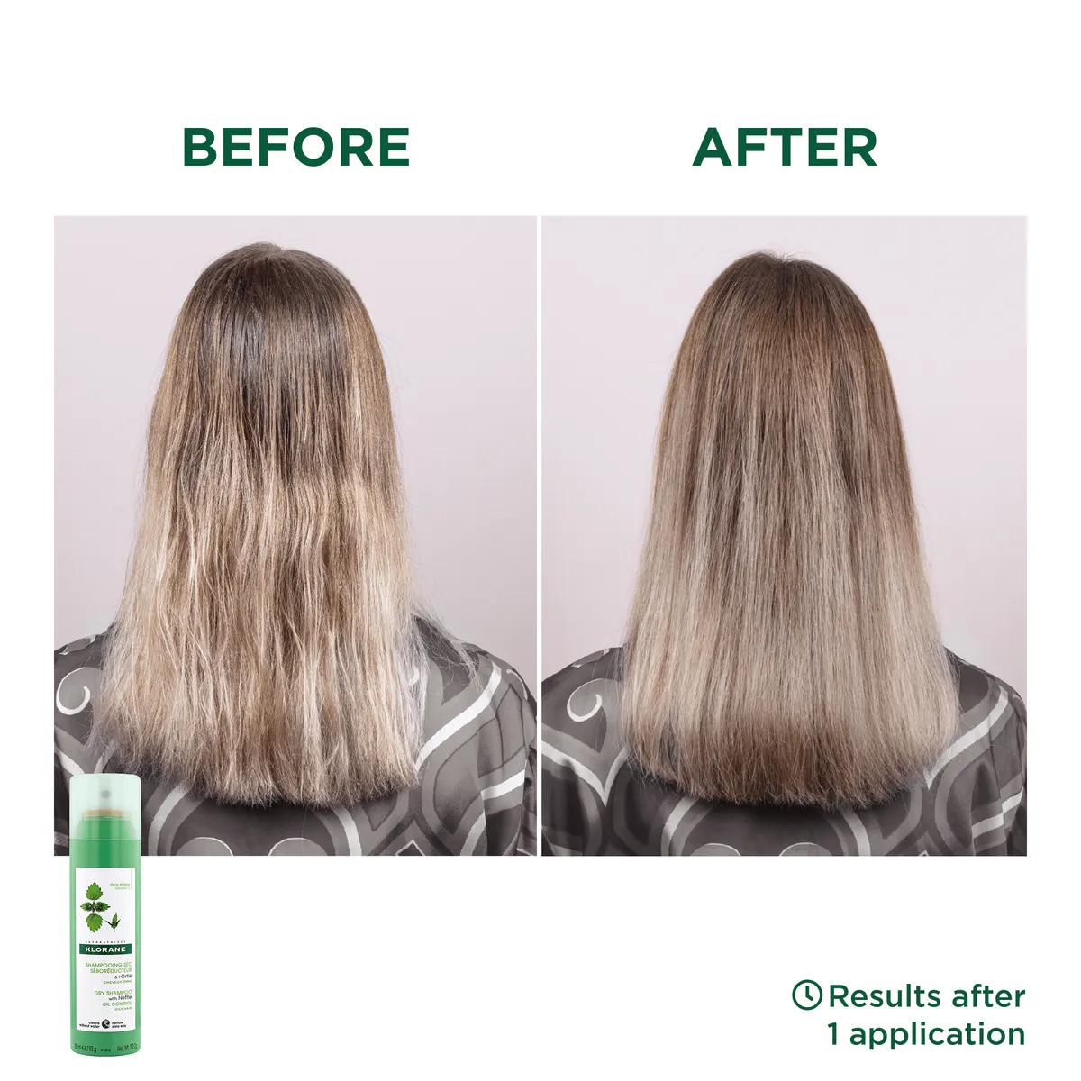 Klorane Dry Shampoo with Nettle 150ml, view 2
