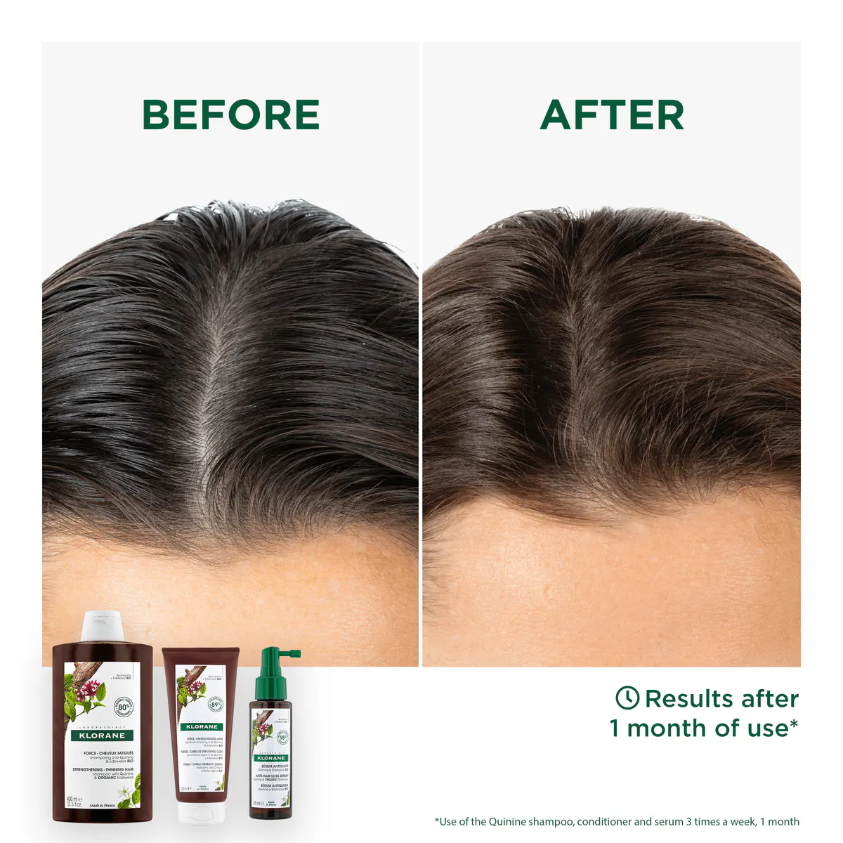 Klorane Strengthening Shampoo With Quinine & Edelweiss 400ml - Thinning Hair, view 4