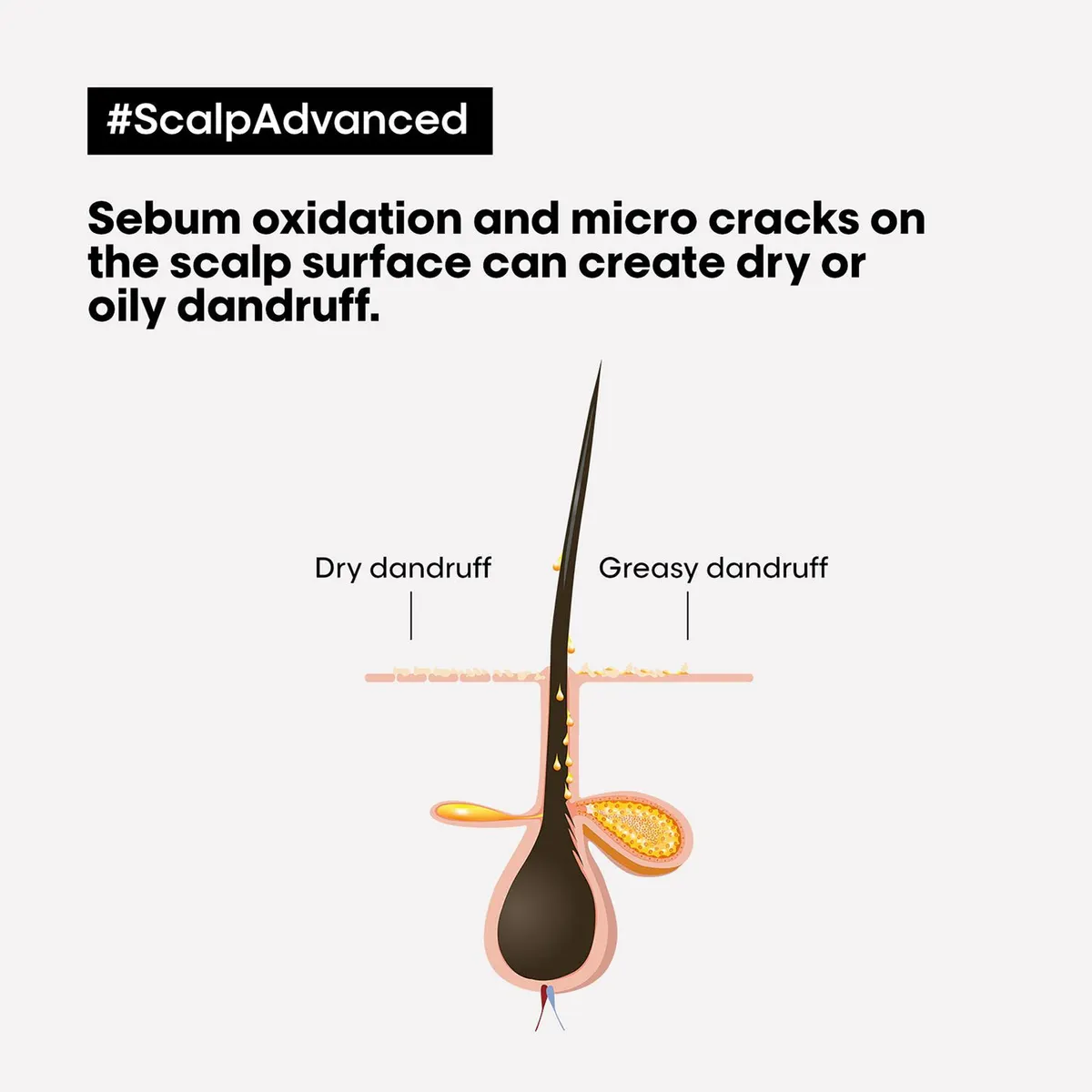 L'Oréal Professionnel Scalp Advanced Anti-Oiliness Duo Bundle, view 5