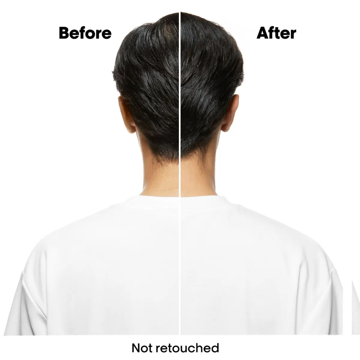 L'Oréal Professionnel Scalp Advanced Anti-Oiliness Mask 250ml, view 3