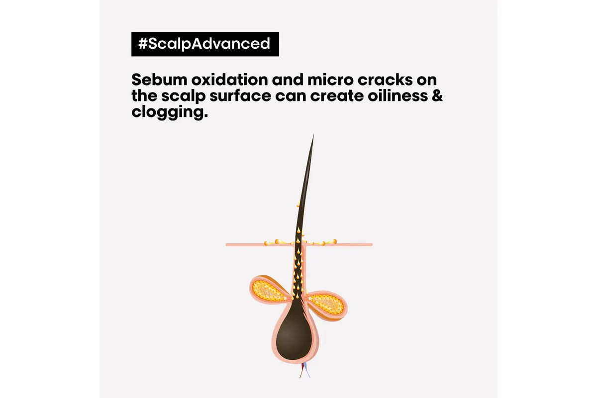 L'Oréal Professionnel Scalp Advanced Anti-Oiliness Mask 250ml, view 5