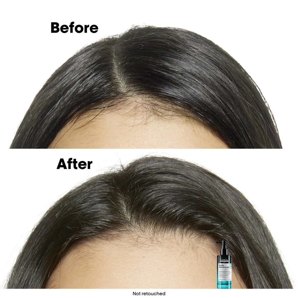 L'Oréal Professionnel Scalp Advanced Anti-Oily Spray 90ml, view 2