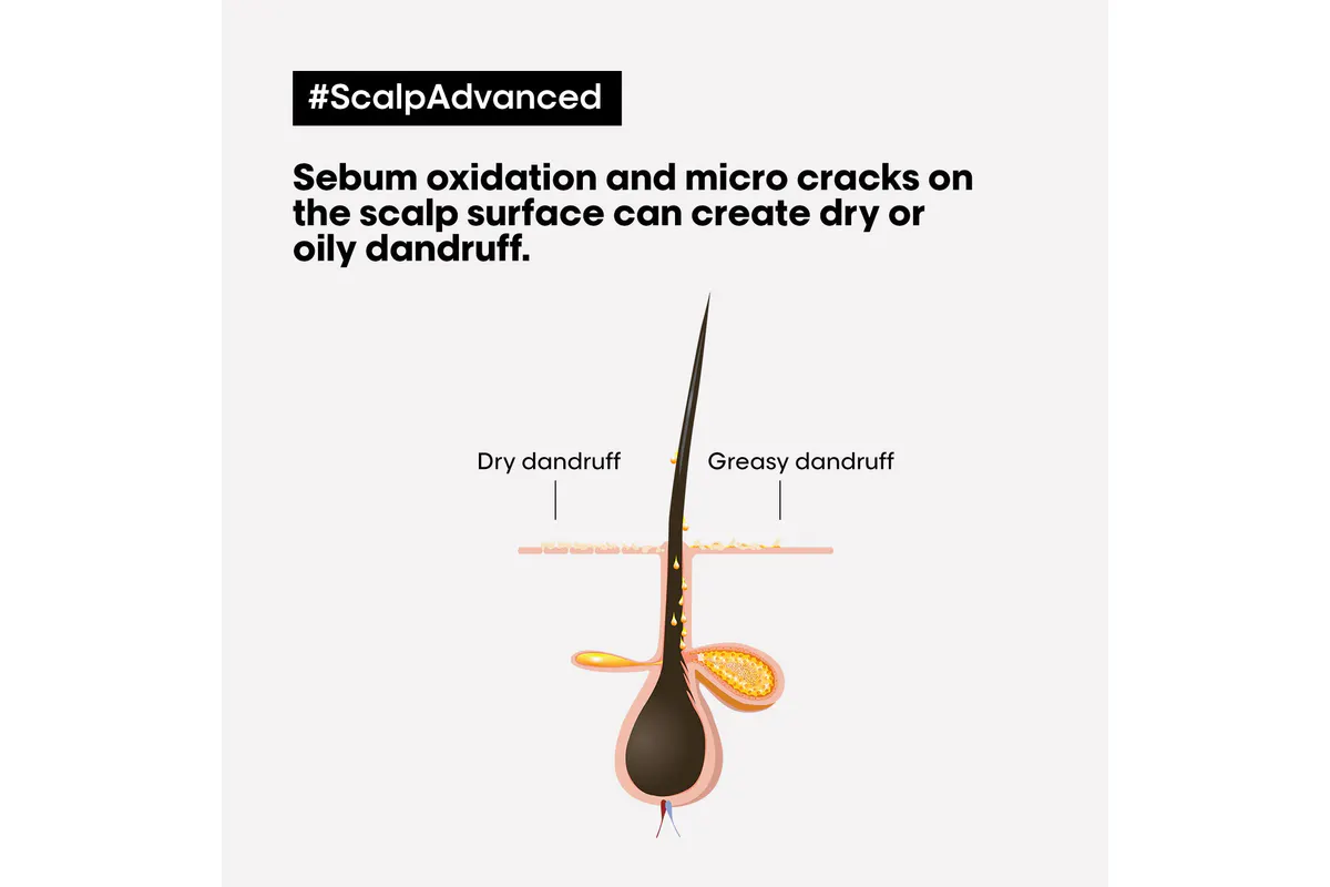 L'Oréal Professionnel Scalp Advanced Dandruff Shampoo 300ml, view 4