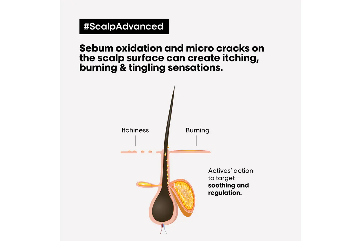 L'Oréal Professionnel Scalp Advanced Discomfort Shampoo 300ml, view 4