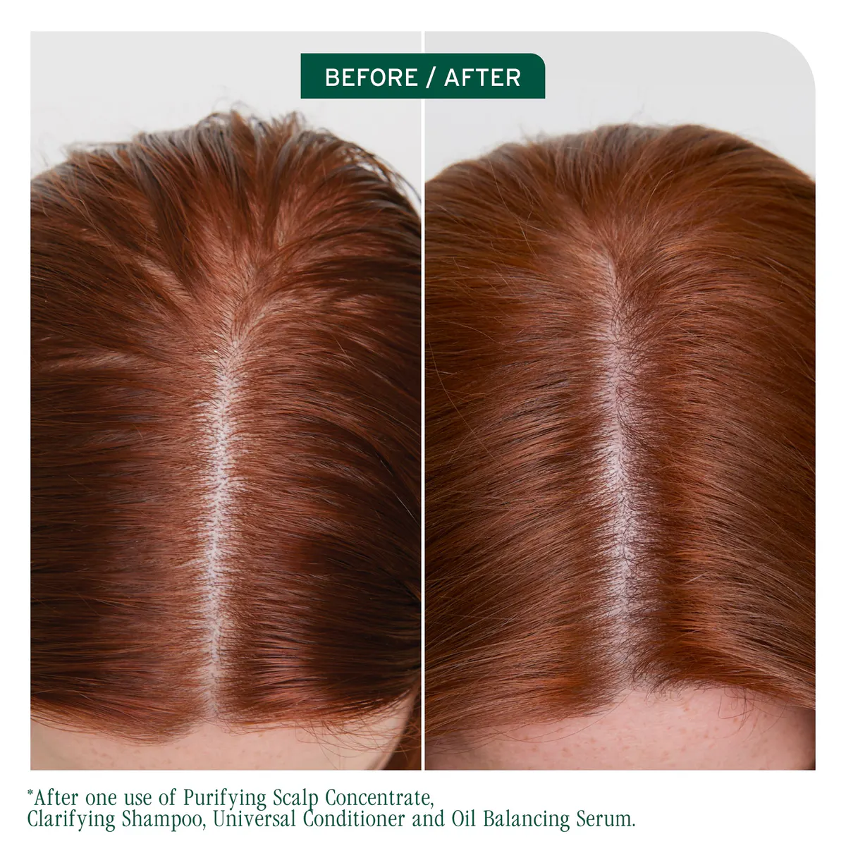 Biolage Scalp Sync Clarifying Shampoo 400ml, view 2