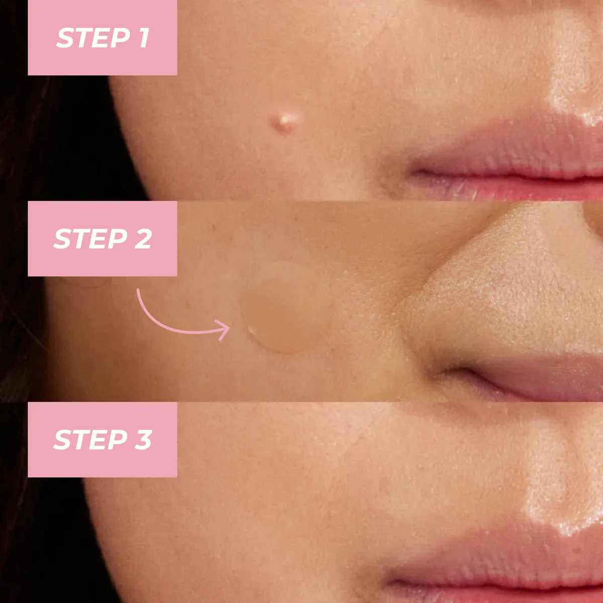 MCoBeauty Miracle Pimple Patches, view 4